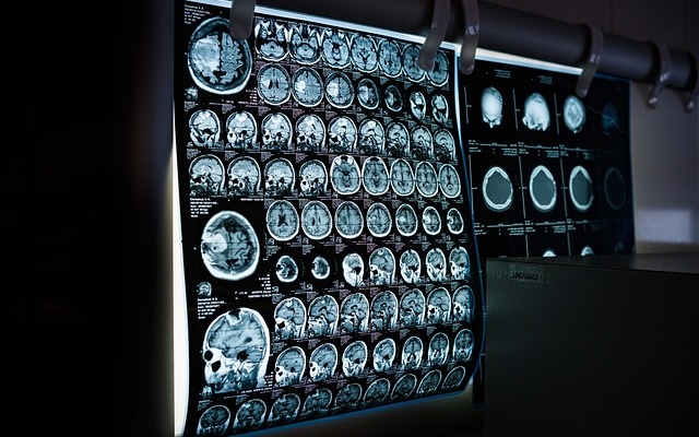 AI Healthcare Case Study